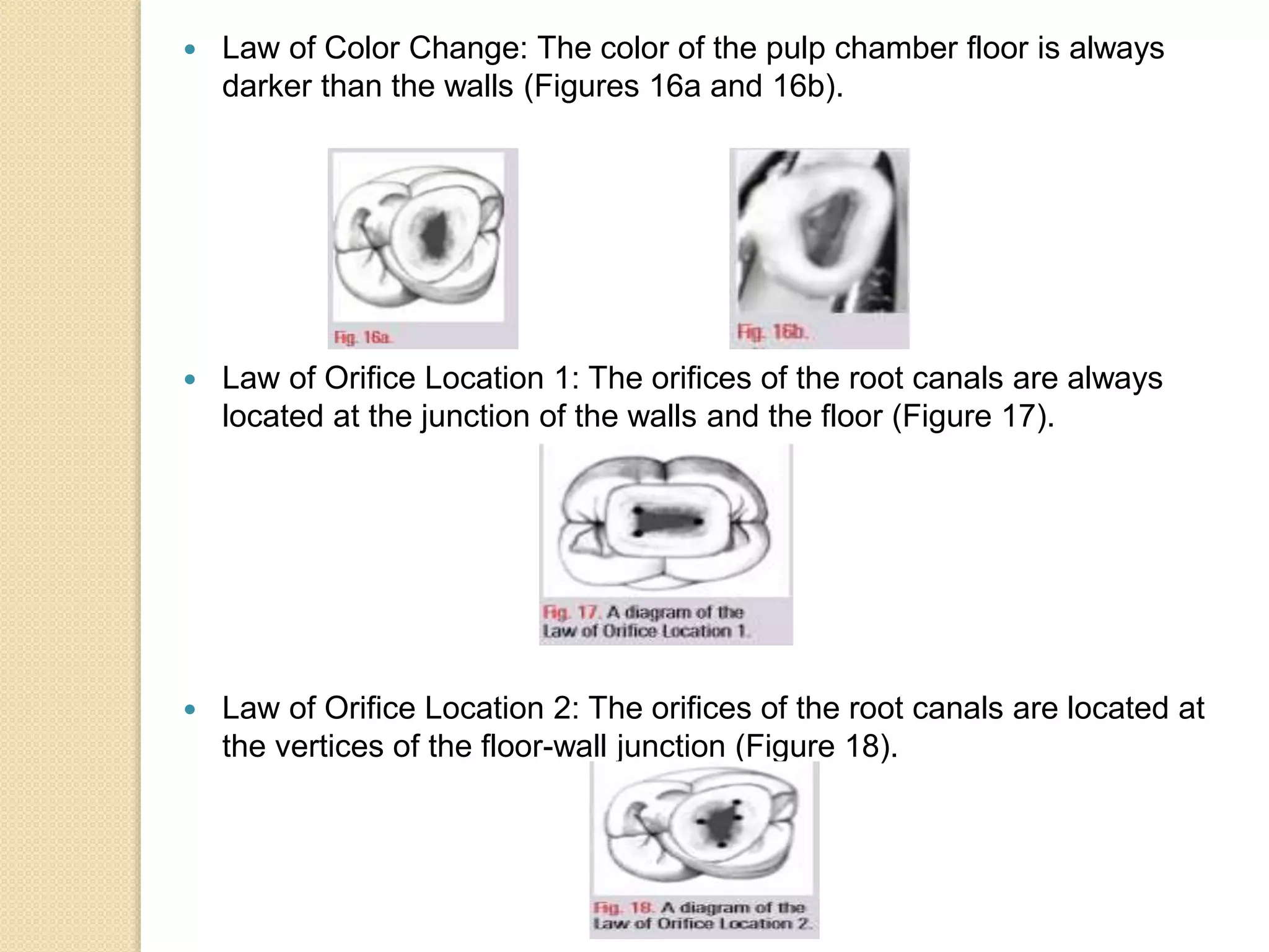  Law of Color Change: The color of the pulp chamber floor is always
darker than the walls (Figures 16a and 16b).
 Law of Orifice Location 1: The orifices of the root canals are always
located at the junction of the walls and the floor (Figure 17).
 Law of Orifice Location 2: The orifices of the root canals are located at
the vertices of the floor-wall junction (Figure 18).
 