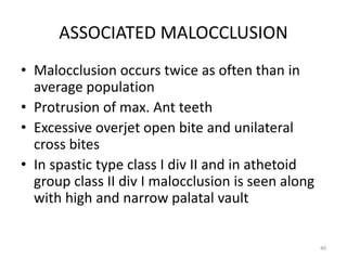 Relationship between orofacial muscles function and malocclusion