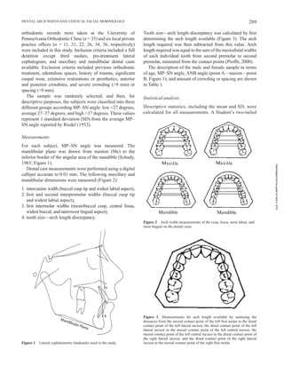 289DENTAL ARCH WIDTH AND VERTICAL FACIAL MORPHOLOGY
orthodontic records were taken at the University of
Pennsylvania Ortho...