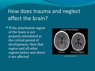 How does trauma and neglect
affect the brain?
If the attachment region
of the brain is not
properly stimulated at
the critical period of
development, then that
region and all other
regions below and above
it are affected 2005 Bruce Perry
 