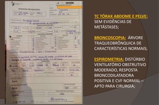 SciELO - Brasil - Anestesia em paciente com síndrome de Rubinstein-Taybi:  relato de caso Anestesia em paciente com síndrome de Rubinstein-Taybi:  relato de caso