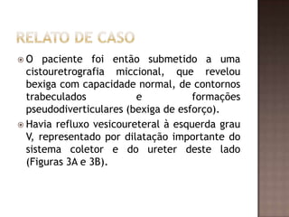 O    paciente foi então submetido a uma
  cistouretrografia miccional, que revelou
  bexiga com capacidade normal, de contornos
  trabeculados           e           formações
  pseudodiverticulares (bexiga de esforço).
 Havia refluxo vesicoureteral à esquerda grau
  V, representado por dilatação importante do
  sistema coletor e do ureter deste lado
  (Figuras 3A e 3B).
 