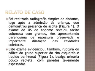  Foi realizada radiografia simples de abdome,
  logo após a admissão da criança, que
  demonstrou presença de ascite (Figura 1). O
  exame de US de abdome revelou ascite
  volumosa com grumos, rins apresentando
  parênquima de espessura preservada e
  importante     dilatação     das    cavidades
  coletoras.
 Este exame evidenciou, também, ruptura do
  cálice do grupo superior do rim esquerdo e
  líquido perirrenal (Figura 2), bexiga urinária
  pouco repleta, com paredes levemente
  espessadas.
 
