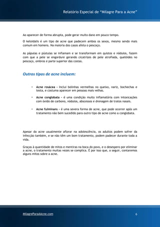 Relatório Especial de “Milagre Para a Acne”
MilagreParaAAcne.com 6
Ao aparecer de forma abrupta, pode gerar muito dano em pouco tempo.
O keloidalis é um tipo de acne que padecem ambos os sexos, mesmo sendo mais
comum em homens. Na maioria dos casos afeta o pescoço.
As pápulas e pústulas se inflamam e se transformam em quistos e nódulos, fazem
com que a pele se engordure gerando cicatrizes de pele atrofiada, quelóides no
pescoço, ombros e parte superior das costas.
Outros tipos de acne incluem:
▪ Acne rosácea – Inclui bolinhas vermelhas no queixo, nariz, bochechas e
testa, e costuma aparecer em pessoas mais velhas.
▪ Acne conglobata – é uma condição muito inflamatória com intoxicações
com óxido de carbono, nódulos, abscessos e drenagem de tratos nasais.
▪ Acne fulminans – é uma severa forma de acne, que pode ocorrer após um
tratamento não bem sucedido para outro tipo de acne como a conglobata.
Apesar da acne usualmente aflorar na adolescência, os adultos podem sofrer da
infecção também, e se não têm um bom tratamento, podem padecer durante toda a
vida.
Graças à quantidade de mitos e mentiras na boca do povo, e o desespero por eliminar
a acne, o tratamento muitas vezes se complica. É por isso que, a seguir, contaremos
alguns mitos sobre a acne.
 