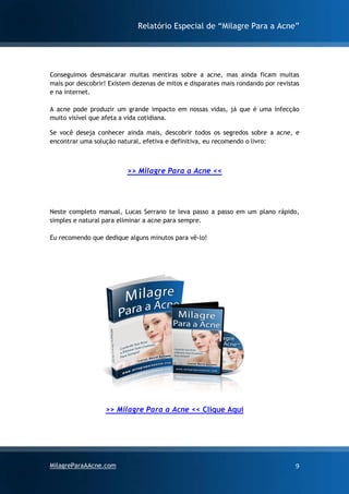 Relatório Especial de “Milagre Para a Acne”
MilagreParaAAcne.com 9
Conseguimos desmascarar muitas mentiras sobre a acne, mas ainda ficam muitas
mais por descobrir! Existem dezenas de mitos e disparates mais rondando por revistas
e na internet.
A acne pode produzir um grande impacto em nossas vidas, já que é uma infecção
muito visível que afeta a vida cotidiana.
Se você deseja conhecer ainda mais, descobrir todos os segredos sobre a acne, e
encontrar uma solução natural, efetiva e definitiva, eu recomendo o livro:
>> Milagre Para a Acne <<
Neste completo manual, Lucas Serrano te leva passo a passo em um plano rápido,
simples e natural para eliminar a acne para sempre.
Eu recomendo que dedique alguns minutos para vê-lo!
>> Milagre Para a Acne << Clique Aqui
 