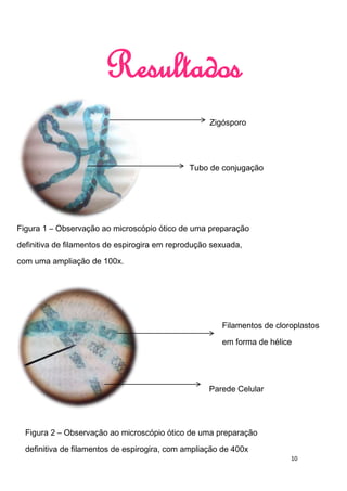 Resultados
                                                    Zigósporo




                                              Tubo de conjugação




Figura 1 – Observação ao microscópio ótico de uma preparação

definitiva de filamentos de espirogira em reprodução sexuada,

com uma ampliação de 100x.




                                                       Filamentos de cloroplastos

                                                       em forma de hélice




                                                    Parede Celular




  Figura 2 – Observação ao microscópio ótico de uma preparação

  definitiva de filamentos de espirogira, com ampliação de 400x
                                                                         10
 