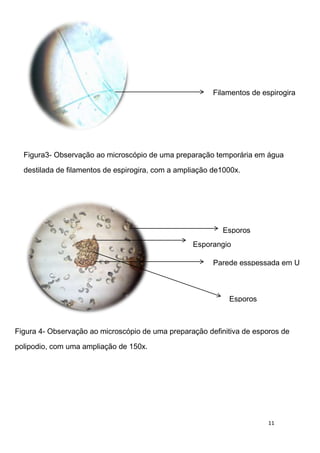 Filamentos de espirogira




  Figura3- Observação ao microscópio de uma preparação temporária em água

  destilada de filamentos de espirogira, com a ampliação de1000x.




                                                           Esporos
                                                   Esporangio

                                                         Parede esspessada em U



                                                             Esporos



Figura 4- Observação ao microscópio de uma preparação definitiva de esporos de

polipodio, com uma ampliação de 150x.
                                                           deespirogira
                                                   deespirogira

                                                         deespirogira



                                                             deespirogira
                                                                        11
 