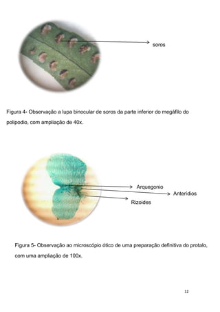 soros




Figura 4- Observação a lupa binocular de soros da parte inferior do megáfilo do
polipodio, com ampliação de 40x.




                                                        Arquegonio
                                                                         Anterídios
                                                      Rizoides




   Figura 5- Observação ao microscópio ótico de uma preparação definitiva do protalo,

   com uma ampliação de 100x.




                                                                             12
 