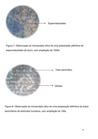 Espermatozóides




 Figura 7- Observação ao microscópio ótico de uma preparação definitiva de
 espermatozóides de touro, com ampliação de 1000x.




                                               Tubo seminífero




                                               Células




Figura 8- Observação ao microscópio ótico de uma preparação definitiva de tubos

seminíferos de testículos humanos, com ampliação de 150x.




                                                                        14
 