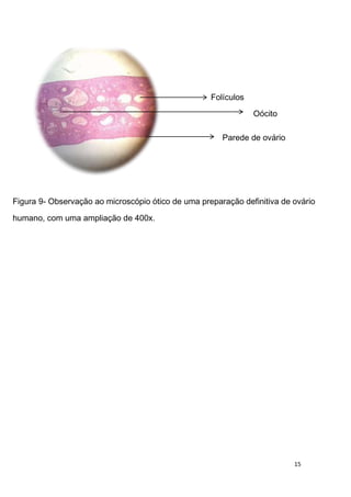 Folículos
                                                                Oócito

                                                       Parede de ovário




Figura 9- Observação ao microscópio ótico de uma preparação definitiva de ovário

humano, com uma ampliação de 400x.




                                                                          15
 