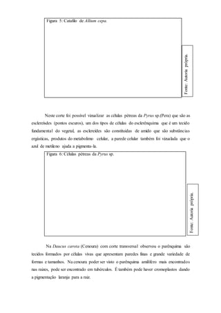 Figura 5: Catafilo de Allium cepa.
Neste corte foi possível vizualizar as células pétreas da Pyrus sp.(Pera) que são as
esclereísdes (pontos escuros), um dos tipos de células do esclerênquima que é um tecido
fundamental do vegetal, as esclereídes são constituidas de amido que são substâncias
ergásticas, produtos do metabolimo celular, a parede celular também foi vizualada que o
azul de metileno ajuda a pigmenta-la.
Figura 6: Células pétreas da Pyrus sp.
Na Daucus carota (Cenoura) com corte transversal observou o parênquima são
tecidos formados por células vivas que apresentam paredes finas e grande variedade de
formas e tamanhos. Na cenoura poder ser visto o parênquima amilífero mais encontrados
nas raizes, pode ser encontrado em tubérculos. É também pode haver cromoplastos dando
a pigmentação laranja para a raiz.
Fonte:Autoriaprópria.
Fonte:Autoriaprópria.
 