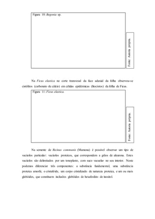 Figura 10: Begonia sp.
Na Ficus elastica no corte transvesal da face adaxial da folha observou-se
cistólitos (carbonato de cálcio) em células epidérmicas (litocistos) da folha de Ficus.
Figura 11: Ficus elastica.
Na semente de Ricinus communis (Mamona) é possível observar um tipo de
vacúolos particular: vacúolos proteicos, que correspondem a grãos de aleurona. Estes
vacúolos são delimitados por um tonoplasto, com suco vacuolar no seu interior. Neste
podemos diferenciar três componentes: a substância fundamental, uma substância
proteica amorfa; o cristalóide, um corpo cristalizado de natureza proteica, e um ou mais
globóides, que constituem inclusões globóides de hexafosfato de inositol.
Fonte:Autoriaprópria.Fonte:Autoriaprópria.
 