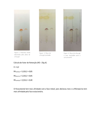 Cálculo de Fator de Retenção (Rf) – [fig.4]:
X = 6,2
RfPadrão1 = 5,3/6,2 = 0,85
RfAmostra = 5,3/6,2 = 0,85
RfPadrão2 = 2,5/6,2 = 0,40
O Paracetamol tem mais afinidade com a fase móvel, pois deslocou mais e a Rifampicina tem
mais afinidade pela fase estacionária.
Figura 2: Amostras sendo
absorvidas pela placa de
sílica gel.
Figura 3: Placa de
sílica gel concluída.
Figura 4: Placa de sílica gel
e suas marcações para o
cálculode Rf.
 