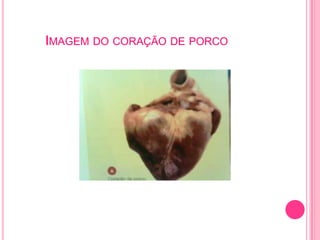 IMAGEM DO CORAÇÃO DE PORCO
 