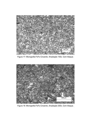Figura 17: Micrografia FoFo Cinzento. Ampliação 100x. Com Ataque.




Figura 18: Micrografia FoFo Cinzento. Ampliação 200x. Com Ataque.
 