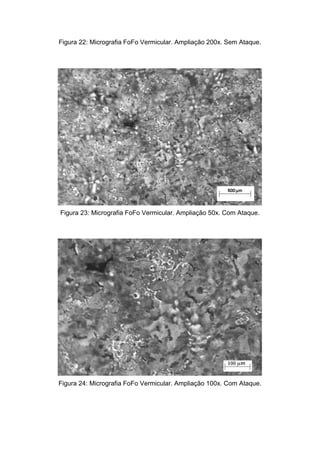 Figura 22: Micrografia FoFo Vermicular. Ampliação 200x. Sem Ataque.




Figura 23: Micrografia FoFo Vermicular. Ampliação 50x. Com Ataque.




Figura 24: Micrografia FoFo Vermicular. Ampliação 100x. Com Ataque.
 