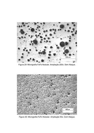 Figura 29: Micrografia FoFo Nodular. Ampliação 200x. Sem Ataque.




Figura 30: Micrografia FoFo Nodular. Ampliação 50x. Com Ataque.
 