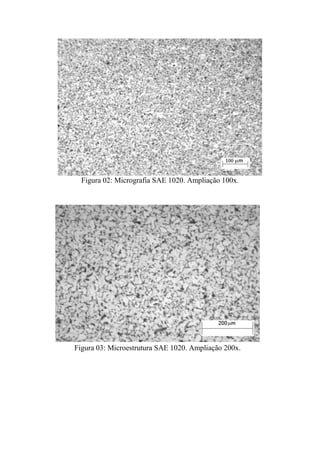 Figura 02: Micrografia SAE 1020. Ampliação 100x.




Figura 03: Microestrutura SAE 1020. Ampliação 200x.
 