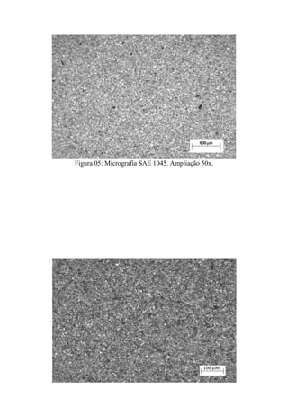 Figura 05: Micrografia SAE 1045. Ampliação 50x.
 