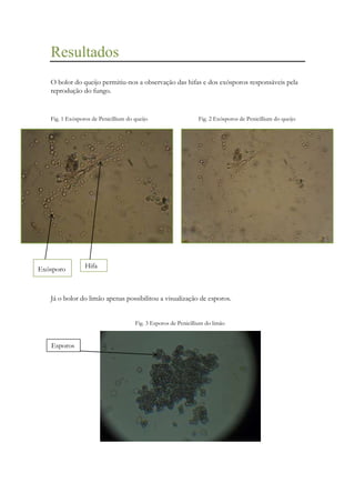 Resultados
O bolor do queijo permitiu-nos a observação das hifas e dos exósporos responsáveis pela
reprodução do fungo.

Fig. 1 Exósporos de Penicillium do queijo

Exósporo
s

Fig. 2 Exósporos de Penicillium do queijo

Hifa

Já o bolor do limão apenas possibilitou a visualização de esporos.
Fig. 3 Esporos de Penicillium do limão

Esporos

 