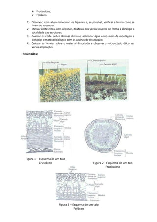  Fruticuloso;
       Foliáceo.

   1) Observar, com a lupa binocular, os líquenes e, se possível, verificar a forma como se
      fixam ao substrato;
   2) Efetuar cortes finos, com o bisturi, dos talos dos vários líquenes de forma a abranger a
      totalidade das estruturas;
   3) Colocar os cortes sobre lâminas distintas, adicionar água como meio de montagem e
      dissociar o material biológico com as agulhas de dissecação;
   4) Colocar as lamelas sobre o material dissociado e observar o microscópio ótico nas
      várias ampliações.

Resultados:




  Figura 1 – Esquema de um talo
             Crustáceo                                    Figura 2 – Esquema de um talo
                                                                    Fruticuloso




                             Figura 3 – Esquema de um talo
                                         Foliáceo
 