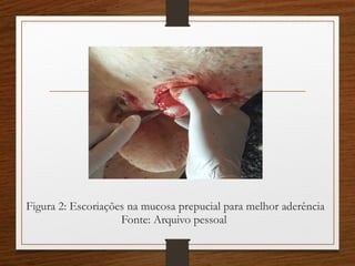 Figura 2: Escoriações na mucosa prepucial para melhor aderência
Fonte: Arquivo pessoal
 