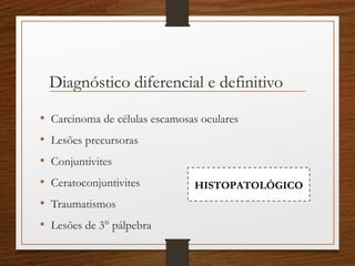 Diagnóstico diferencial e definitivo
• Carcinoma de células escamosas oculares
• Lesões precursoras
• Conjuntivites
• Ceratoconjuntivites
• Traumatismos
• Lesões de 3° pálpebra
HISTOPATOLÓGICO
 