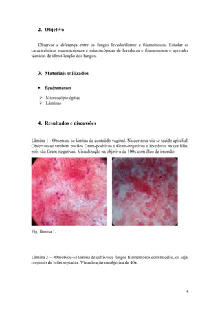 4
2. Objetivo
Observar a diferença entre os fungos leveduriforme e filamentosos. Estudar as
características macroscópicas e microscópicas de leveduras e filamentosos e aprender
técnicas de identificação dos fungos.
3. Materiais utilizados
 Equipamentos
 Microscópio óptico
 Lâminas
4. Resultados e discussões
Lâmina 1 - Observou-se lâmina de conteúdo vaginal. Na cor rosa viu-se tecido epitelial.
Observou-se também bacilos Gram-positivos e Gram-negativos e leveduras na cor lilás,
pois são Gram-negativas. Visualização na objetiva de 100x com óleo de imersão.
Fig. lâmina 1.
Lâmina 2 –– Observou-se lâmina de cultivo de fungos filamentosos com micélio, ou seja,
conjunto de hifas septadas. Visualização na objetiva de 40x.
 