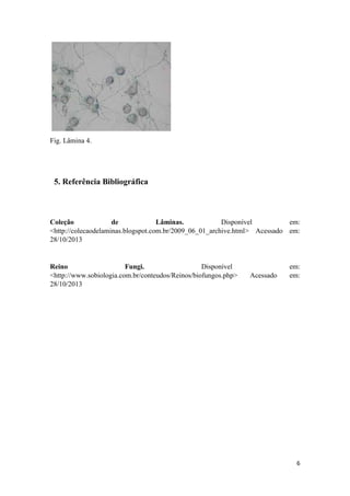 6
Fig. Lâmina 4.
5. Referência Bibliográfica
Coleção de Lâminas. Disponível em:
<http://colecaodelaminas.blogspot.com.br/2009_06_01_archive.html> Acessado em:
28/10/2013
Reino Fungi. Disponível em:
<http://www.sobiologia.com.br/conteudos/Reinos/biofungos.php> Acessado em:
28/10/2013
 
