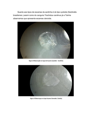 Quanto aos tipos de escamas da sardinha é do tipo cycloide (Sardinella
brasiliensis ),assim como do canguira Trachiotus carolinus já a Tainha
observamos que apresenta escamas ctenoide.
Figura 8 Observação na lupa de Escama Cycloide – Sardinha
Figura 9 Observaçao na lupa Escama Ctenoide ( Tainha)
 