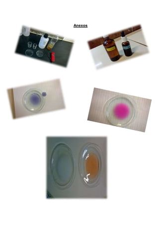 Anexos 
