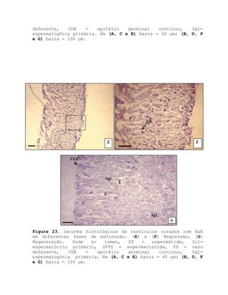deferente, CGE = epitélio germinal contínuo, Sg1=
espermatogônia primária. Em (A, C e E) barra = 40 μm; (B, D, F
e G) barra = 100 μm.
Figura 23. Secções histológicas de testículos corados com H&E
em diferentes fases de maturação. (E) e (F) Regressão, (G)
Regeneração. Onde L= lúmen, ST = espermátide, Sc1=
espermatócito primário, SPTZ = espermatozóide, VD = vaso
deferente, CGE = epitélio germinal contínuo, Sg1=
espermatogônia primária. Em (A, C e E) barra = 40 μm; (B, D, F
e G) barra = 100 μm.
 