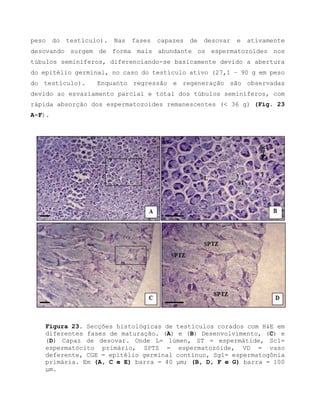 peso do testículo). Nas fases capazes de desovar e ativamente
desovando surgem de forma mais abundante os espermatozoides nos
túbulos seminíferos, diferenciando-se basicamente devido a abertura
do epitélio germinal, no caso do testículo ativo (27,1 – 90 g em peso
do testículo). Enquanto regressão e regeneração são observadas
devido ao esvaziamento parcial e total dos túbulos seminíferos, com
rápida absorção dos espermatozoides remanescentes (< 36 g) (Fig. 23
A-F).
Figura 23. Secções histológicas de testículos corados com H&E em
diferentes fases de maturação. (A) e (B) Desenvolvimento, (C) e
(D) Capaz de desovar. Onde L= lúmen, ST = espermátide, Sc1=
espermatócito primário, SPTZ = espermatozóide, VD = vaso
deferente, CGE = epitélio germinal contínuo, Sg1= espermatogônia
primária. Em (A, C e E) barra = 40 μm; (B, D, F e G) barra = 100
μm.
 