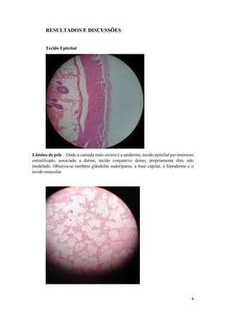 4
RESULTADOS E DISCUSSÕES
Tecido Epitelial
Lâmina de pele – Onde a camada mais escura é a epiderme, tecido epitelial pavimentoso
estratificado, associado a derme, tecido conjuntivo denso, propriamente dito, não
modelado. Observa-se também glândulas sudoríparas, a base capilar, a hipoderme e o
tecido muscular.
 