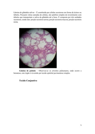 5
Lâmina de glândula salivar – É constituída por células secretoras em forma de ácinos ou
túbulos. Possuem várias camadas de células, são epitélios simples de revestimento com
túbulos que transportam a saliva da glândula até a boca. É composta por três unidades
secretoras, sendo elas: porção secretora serosa, porção secretora mucosa, porção secretora
mista.
Lâmina de pulmão – Observou-se os alvéolos pulmonares, onde ocorre a
hematose, este órgão é revestido por tecido epitelial pavimentoso simples.
Tecido Conjuntivo
 