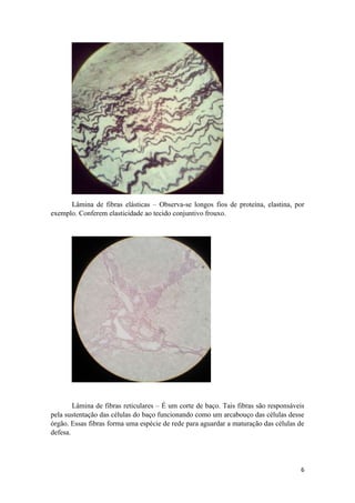 6
Lâmina de fibras elásticas – Observa-se longos fios de proteína, elastina, por
exemplo. Conferem elasticidade ao tecido conjuntivo frouxo.
Lâmina de fibras reticulares – É um corte de baço. Tais fibras são responsáveis
pela sustentação das células do baço funcionando como um arcabouço das células desse
órgão. Essas fibras forma uma espécie de rede para aguardar a maturação das células de
defesa.
 
