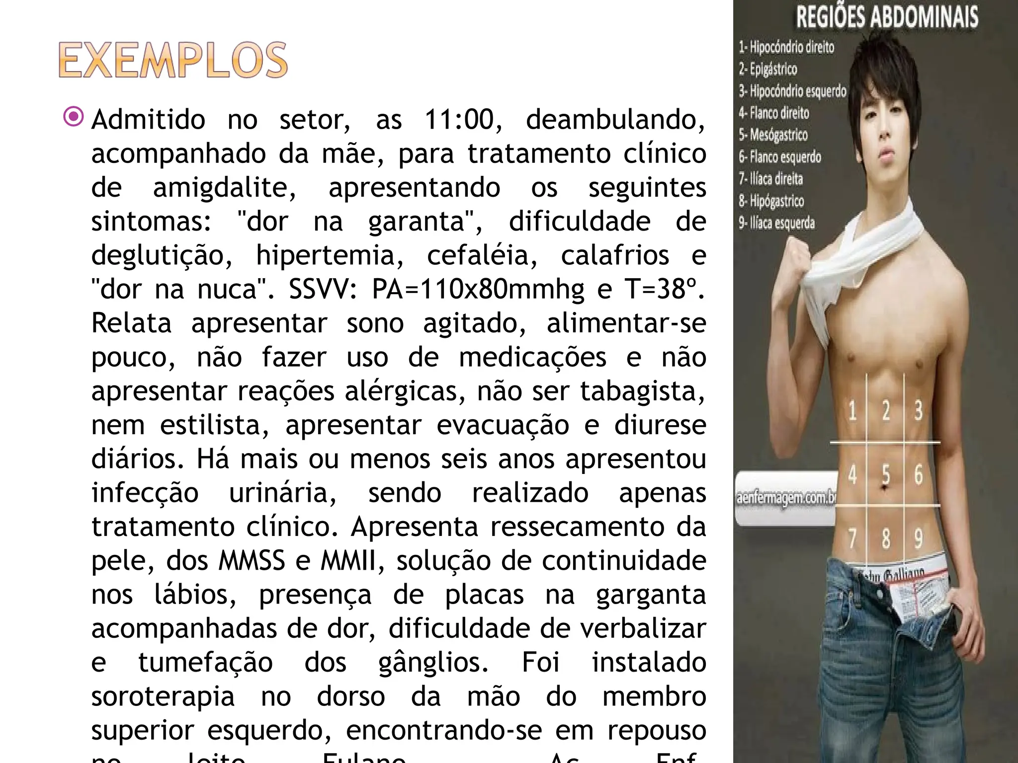  Admitido no setor, as 11:00, deambulando,
acompanhado da mãe, para tratamento clínico
de amigdalite, apresentando os seguintes
sintomas: "dor na garanta", dificuldade de
deglutição, hipertemia, cefaléia, calafrios e
"dor na nuca". SSVV: PA=110x80mmhg e T=38º.
Relata apresentar sono agitado, alimentar-se
pouco, não fazer uso de medicações e não
apresentar reações alérgicas, não ser tabagista,
nem estilista, apresentar evacuação e diurese
diários. Há mais ou menos seis anos apresentou
infecção urinária, sendo realizado apenas
tratamento clínico. Apresenta ressecamento da
pele, dos MMSS e MMII, solução de continuidade
nos lábios, presença de placas na garganta
acompanhadas de dor, dificuldade de verbalizar
e tumefação dos gânglios. Foi instalado
soroterapia no dorso da mão do membro
superior esquerdo, encontrando-se em repouso
 