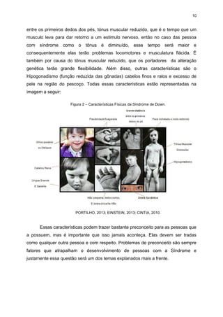 10

entre os primeiros dedos dos pés, tónus muscular reduzido, que é o tempo que um
musculo leva para dar retorno a um estimulo nervoso, então no caso das pessoa
com

síndrome

como

o

tônus

é

diminuído,

esse

tempo

será

maior

e

consequentemente elas terão problemas locomotores e musculatura flácida. É
também por causa do tônus muscular reduzido, que os portadores da alteração
genética terão grande flexibilidade. Além disso, outras características são o
Hipogonadismo (função reduzida das gônadas) cabelos finos e ralos e excesso de
pele na região do pescoço. Todas essas características estão representadas na
imagem a seguir:
Figura 2 – Características Físicas da Síndrome de Down.

PORTILHO, 2013; EINSTEIN, 2013; CINTIA, 2010.

Essas características podem trazer bastante preconceito para as pessoas que
a possuem, mas é importante que isso jamais aconteça. Elas devem ser tradas
como qualquer outra pessoa e com respeito. Problemas de preconceito são sempre
fatores que atrapalham o desenvolvimento de pessoas com a Síndrome e
justamente essa questão será um dos temas explanados mais a frente.

 