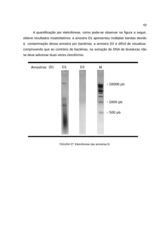65
A quantificação por eletroforese, como pode-se observar na figura a seguir,
obteve resultados insatisfatórios; a amostra D1 apresentou múltiplas bandas devido
à contaminação dessa amostra por bactérias; a amostra D2 é difícil de visualizar,
comprovando que ao contrário de bactérias, na extração de DNA de leveduras não
se deve adicionar duas vezes clorofórmio.
FIGURA 37: Eletroforese das amostras D.
 