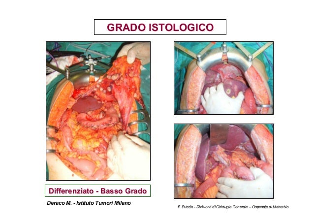 Relazione Carcinosi Puccio