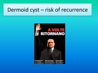 Dermoid cyst – risk of recurrence
 