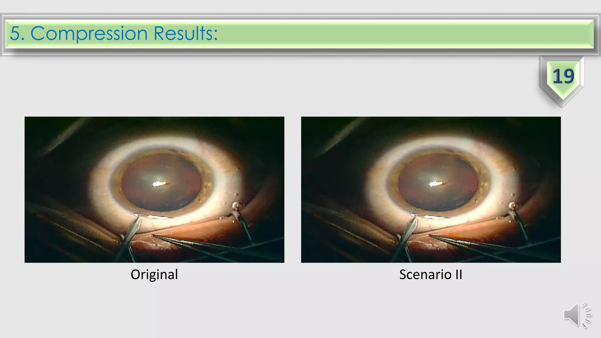 5. Compression Results:
Original Scenario II
 