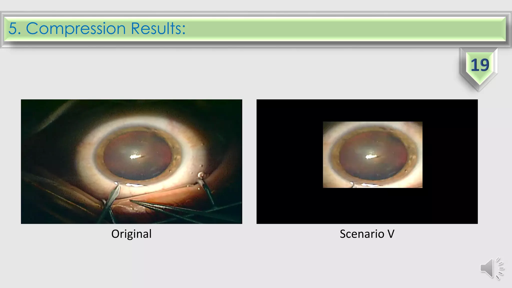 5. Compression Results:
Original Scenario V
 