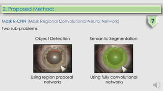 2. Proposed Method:
Mask R-CNN (Mask Regional Convolutional Neural Network)
Two sub-problems:
Object Detection Semantic Segmentation
Using region proposal
networks
Using fully convolutional
networks