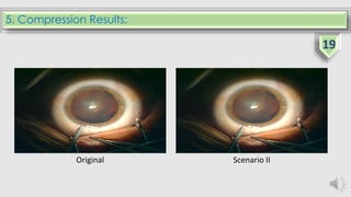 5. Compression Results:
Original Scenario II