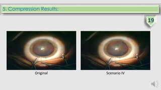 5. Compression Results:
Original Scenario IV