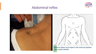 Reflexes (Deep, superficial & Pathological Reflexes) | PPTX