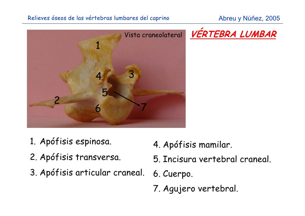 Relieves óseos de las vértebras torácicas, lumbares y sacras, costill…