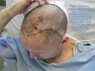 Visto que Ele é a ressurreição e a vida, ainda quando os crentes enfrentam a morte é Cristo quem lhes dá o poder de dizer: A minha alma está segura, pois tenho em mim escondida a sua Palavra."