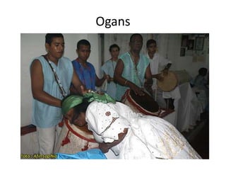 Ogans
 